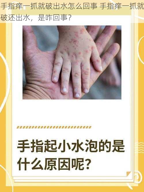 手指痒一抓就破出水怎么回事 手指痒一抓就破还出水，是咋回事？